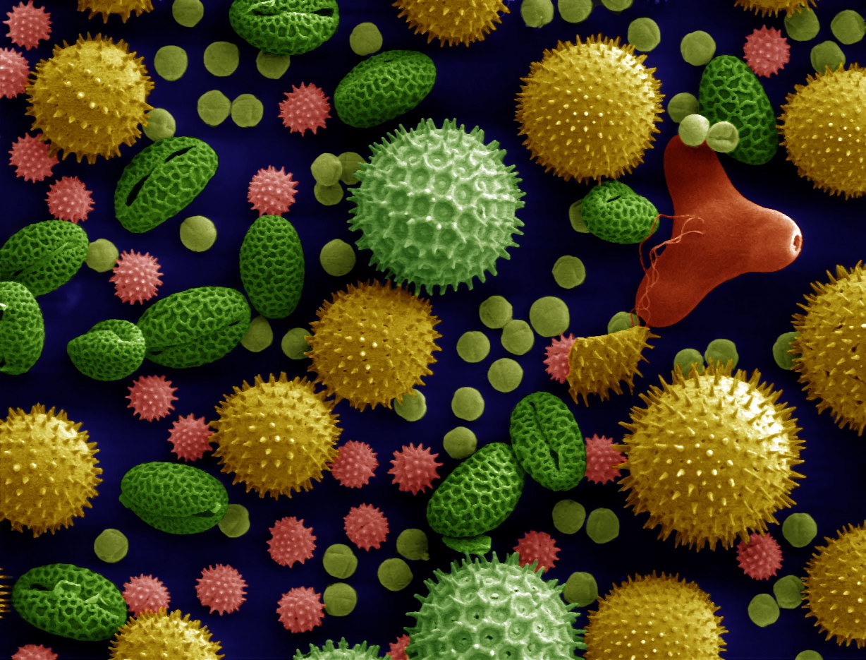 Pollen picture from Dartmouth College Electron Microscope Facility